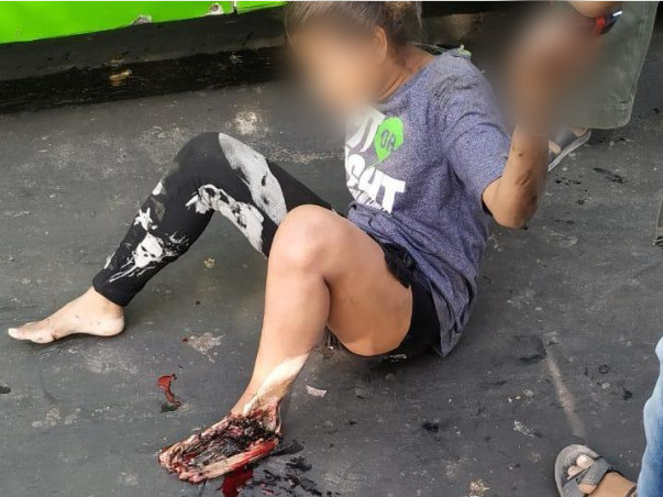 Help Judo Karate Medalist Lori recover from an Accident