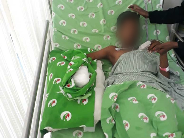 Right Hand Plastic Surgery