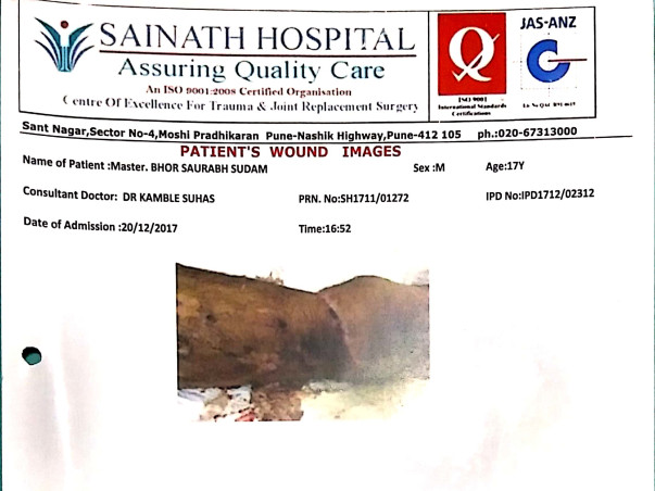 Please Help My Cousin Who Met With A Serious Accident