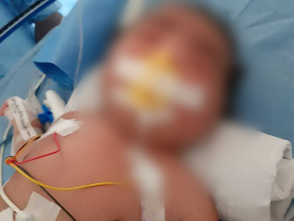 Help 4-day-old baby Undergo Surgery For Anorectal Malformation