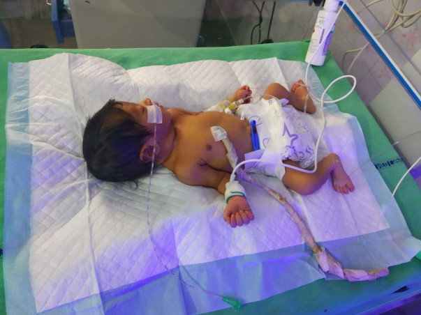 Support Me to Save My 6 Days Old Daughter, Who is in ICU.