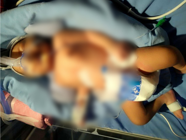 Help My 22 Days Old Baby Recover From A Critical Medical Issue.