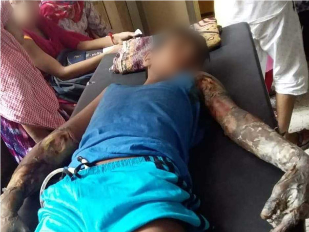 Help Sahil Recover from a Severe Electric shock