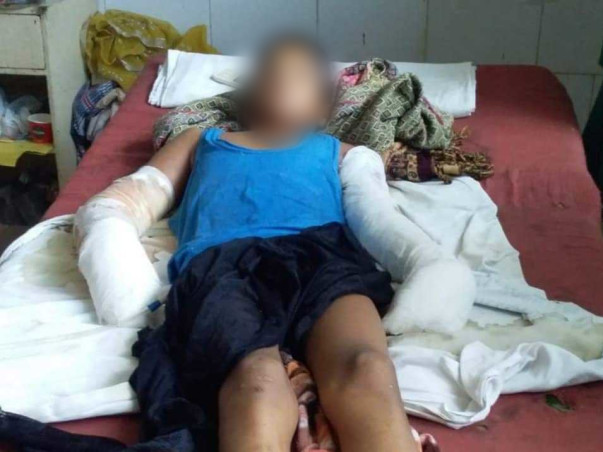 Help Sahil Recover from a Severe Electric shock