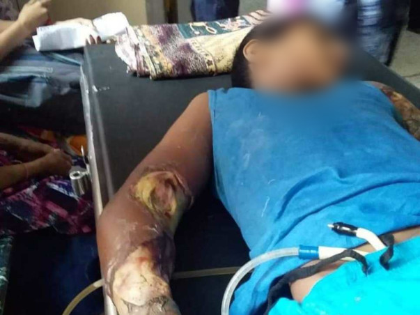 Help Sahil Recover from a Severe Electric shock