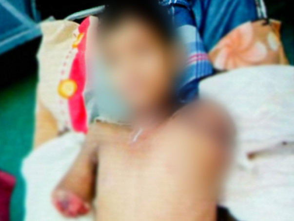 Help Sahil Recover from a Severe Electric shock