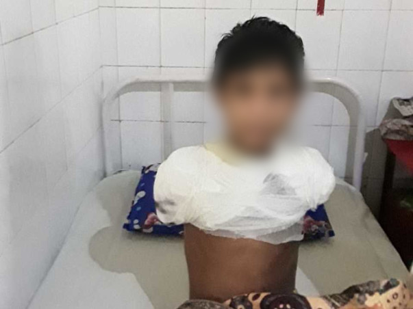 Help Sahil Recover from a Severe Electric shock