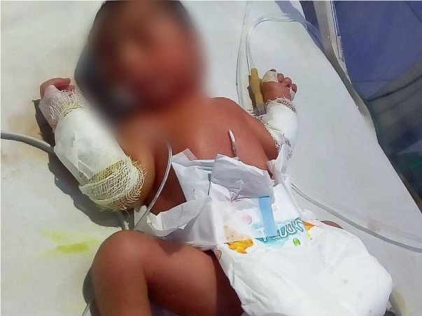 Helpless Parents Have Lost Their 6 Babies Earlier,Please Help Them.