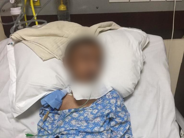 Help My Son From Brain Haemorrhage