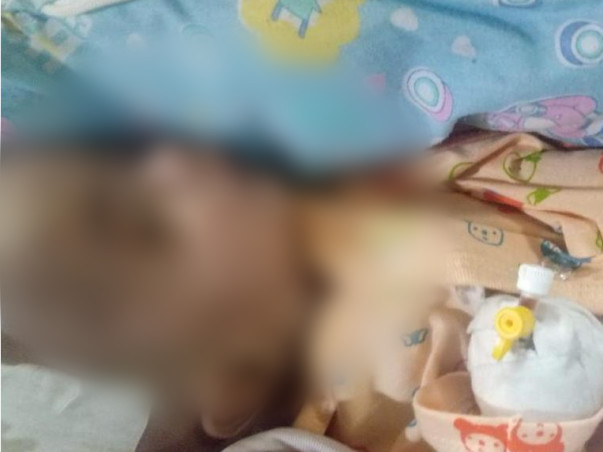 Help 2 Months Old Mahad Recover From Hypercephalus