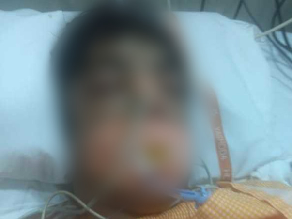 Help 14 Year Old Dhaval Save His Life From Multiple Organ Failure