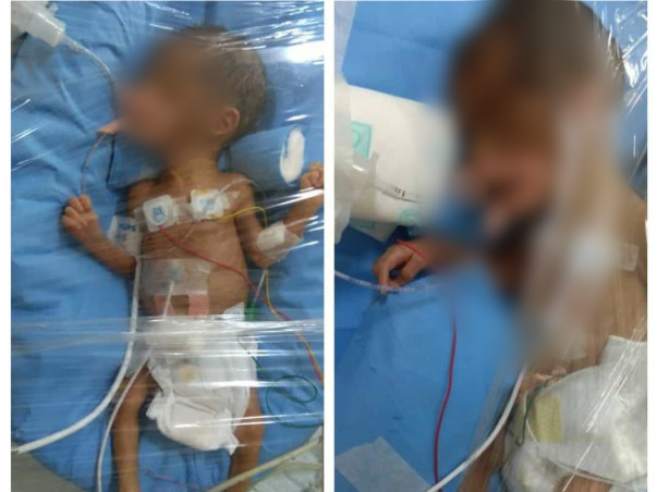 Help Swetha's Baby Survive