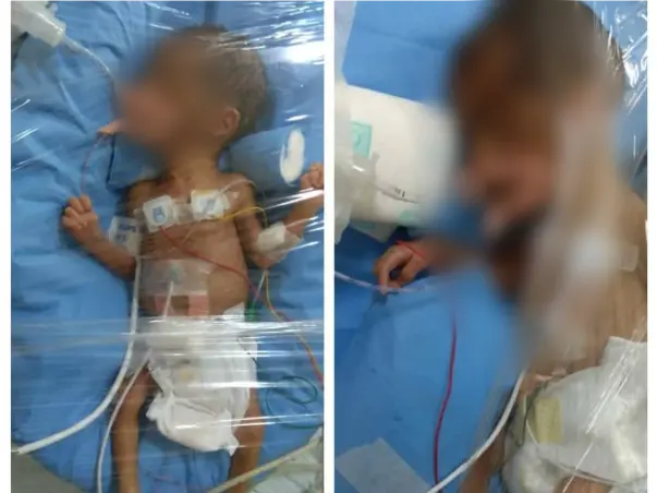 Help Swetha's Baby Survive