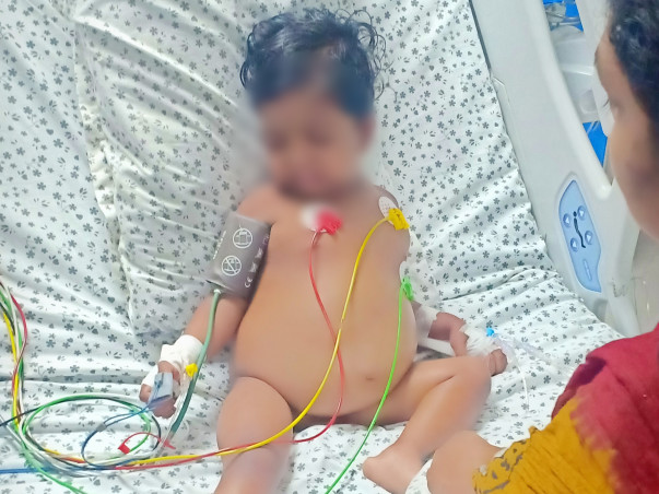 Help and Save 3 Year-Old-Baby Riyana Revicer From Kidney Failure