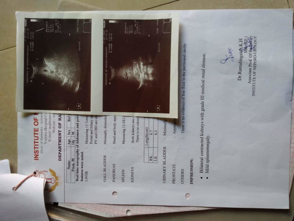 Help Baby Prem for Kidney Dialysis