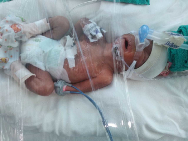 Support Radha's Twin Babies recover for Development & Weight Gain