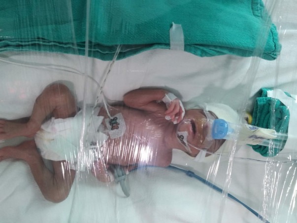 Support Radha's Twin Babies recover for Development & Weight Gain