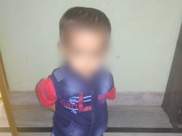 My Relative Is Struggling With Malignant Infantile Osteopetrosis, Help