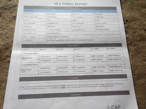 My Relative Is Struggling With Malignant Infantile Osteopetrosis, Help