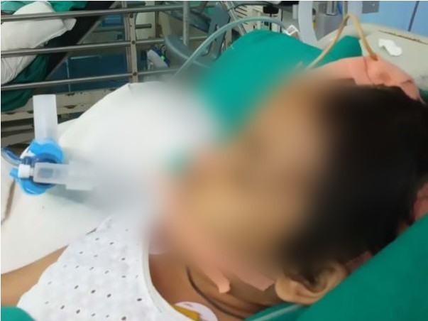 8 yrs old Gungun struggling for survival with her Brain Tumor