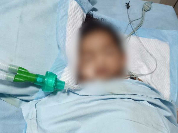 Support Baby Neha to recover from Burn injury