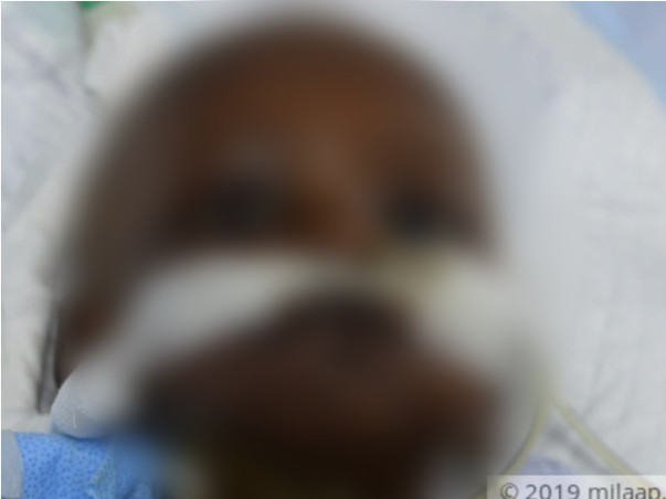 Help Yazhini Recover From Leukaemia