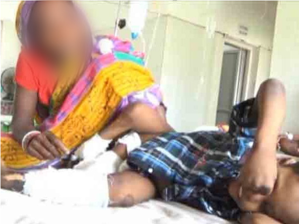 Help 11 Years Old Indian Boy Born With An Extra Leg Undergo Surgery