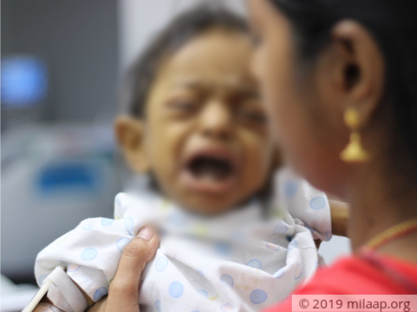 10-Month-Old Was Refused Treatment By 3 Hospitals For Liver Failure