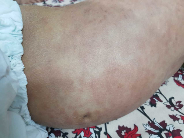 Help Hamza Fight Blood Cancer