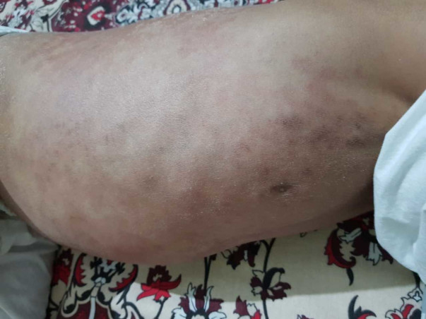 Help Hamza Fight Blood Cancer