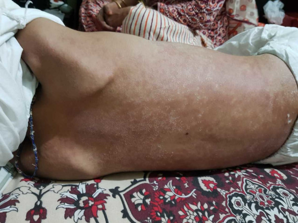 Help Hamza Fight Blood Cancer