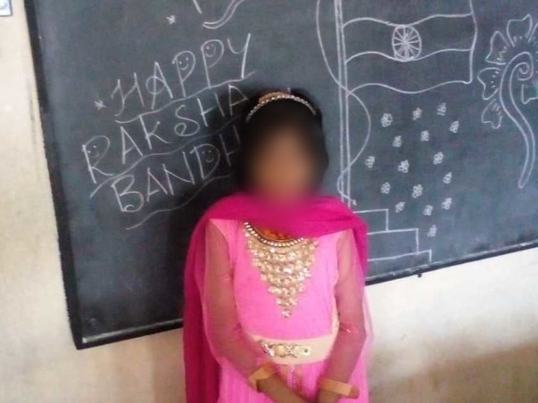 Help My Cousin Fight Dorso Lumbar Scoliosis