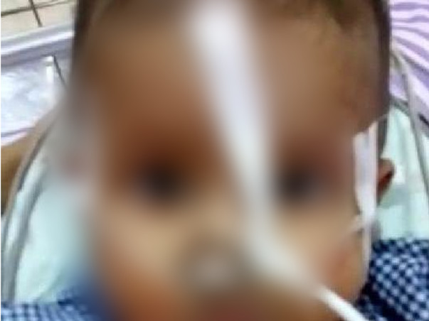 Please Save This Little Master From Truncus Arteriosus