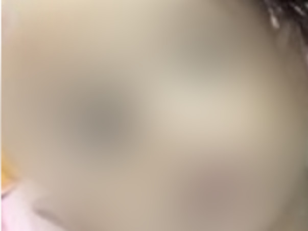 Save Ananth Life From Complex Congenital Heart Disease