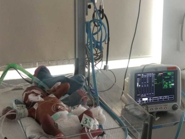 3 Days Old Baby Of Nandini  Needs Your Help Fight Valvular Stenosis