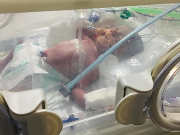 16 Days Old Baby Samuel Isaac Needs Your Help Fight Diaphragmatic Hernia