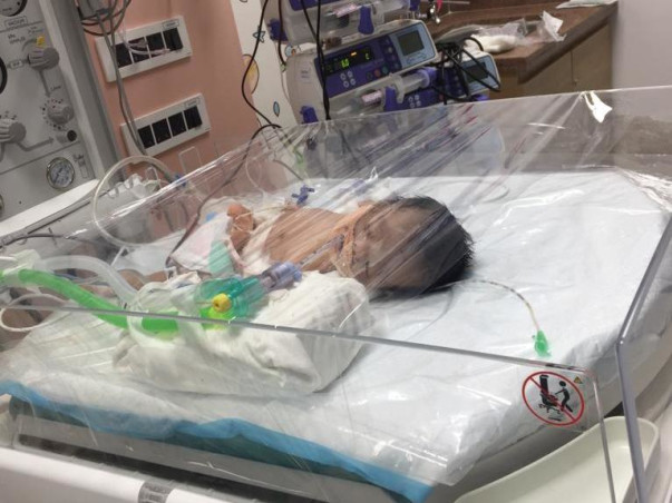 16 Days Old Baby Samuel Isaac Needs Your Help Fight Diaphragmatic Hernia