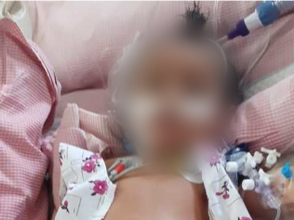 8 Months Old Mintu Needs Your Help Fight HLM secondary