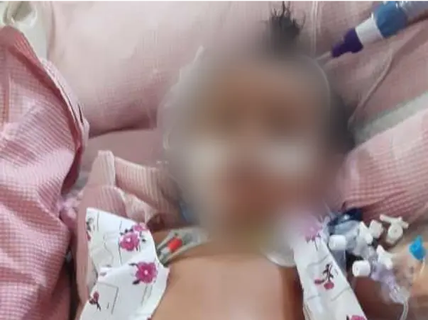 8 Months Old Mintu Needs Your Help Fight HLM secondary