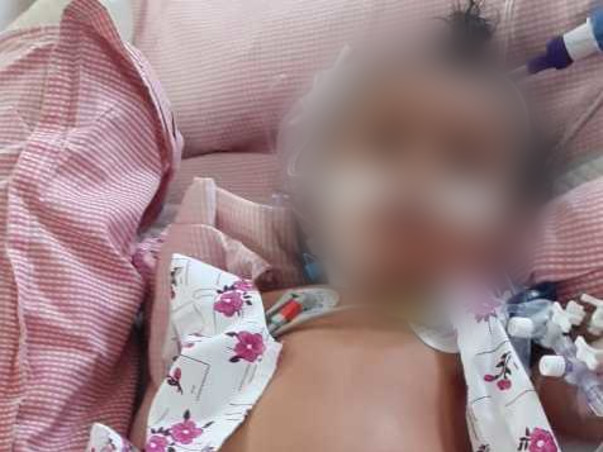 8 Months Old Mintu Needs Your Help Fight HLM secondary