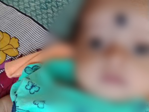 5 Months Old Baby Prapti Panda Needs Your Help Fight Osteopetrosis