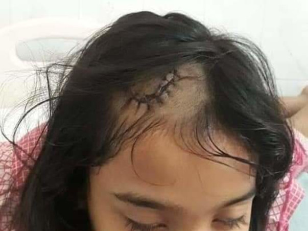 Help My Friend Sonali Mukherjee Fight Brain Tumor