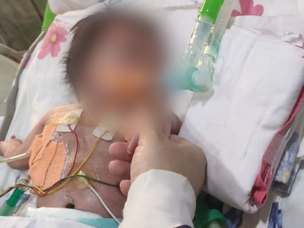 26 Days Old Baby Needs Your Help Fight Hydrops with chylothorax