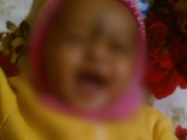 Without Your Help, This Baby Could Lose His Sight Just Like His Father