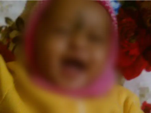 Without Your Help, This Baby Could Lose His Sight Just Like His Father