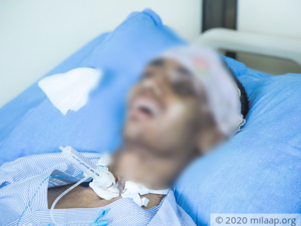 Support Janesh To Recover From Coma