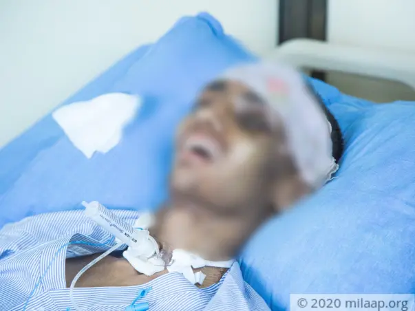 Support Janesh To Recover From Coma