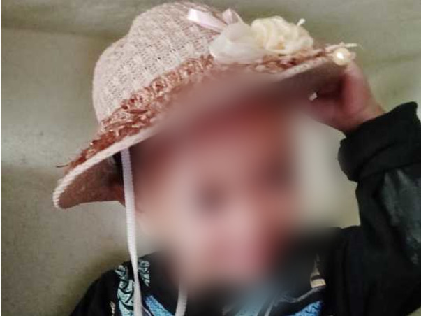 2 Years Old Anaya Mehivish Needs Your Help To Recover From Body Burns