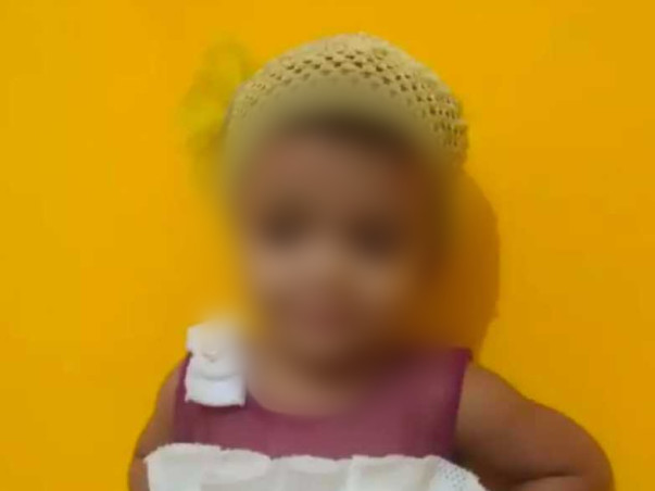 2 Years Old Anaya Mehivish Needs Your Help To Recover From Body Burns