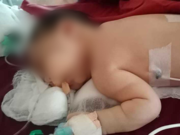 Help This 5 Days Old Fight Meconium Aspiration Syndrome